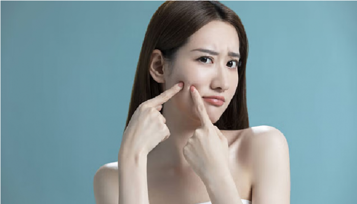 ব্রণ সারাতে বেইকিং সোডা