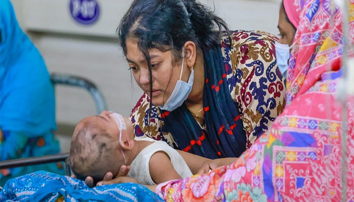 দেশে হাম ও হামের উপসর্গ নিয়ে আরও ৩ শিশুর মৃত্যু